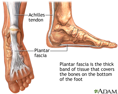 bottom of heel pain