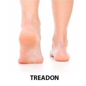 treadon