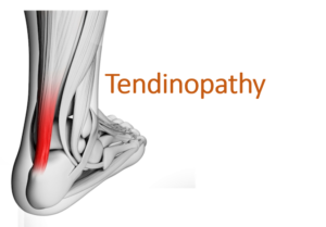 tendinopathy-banner